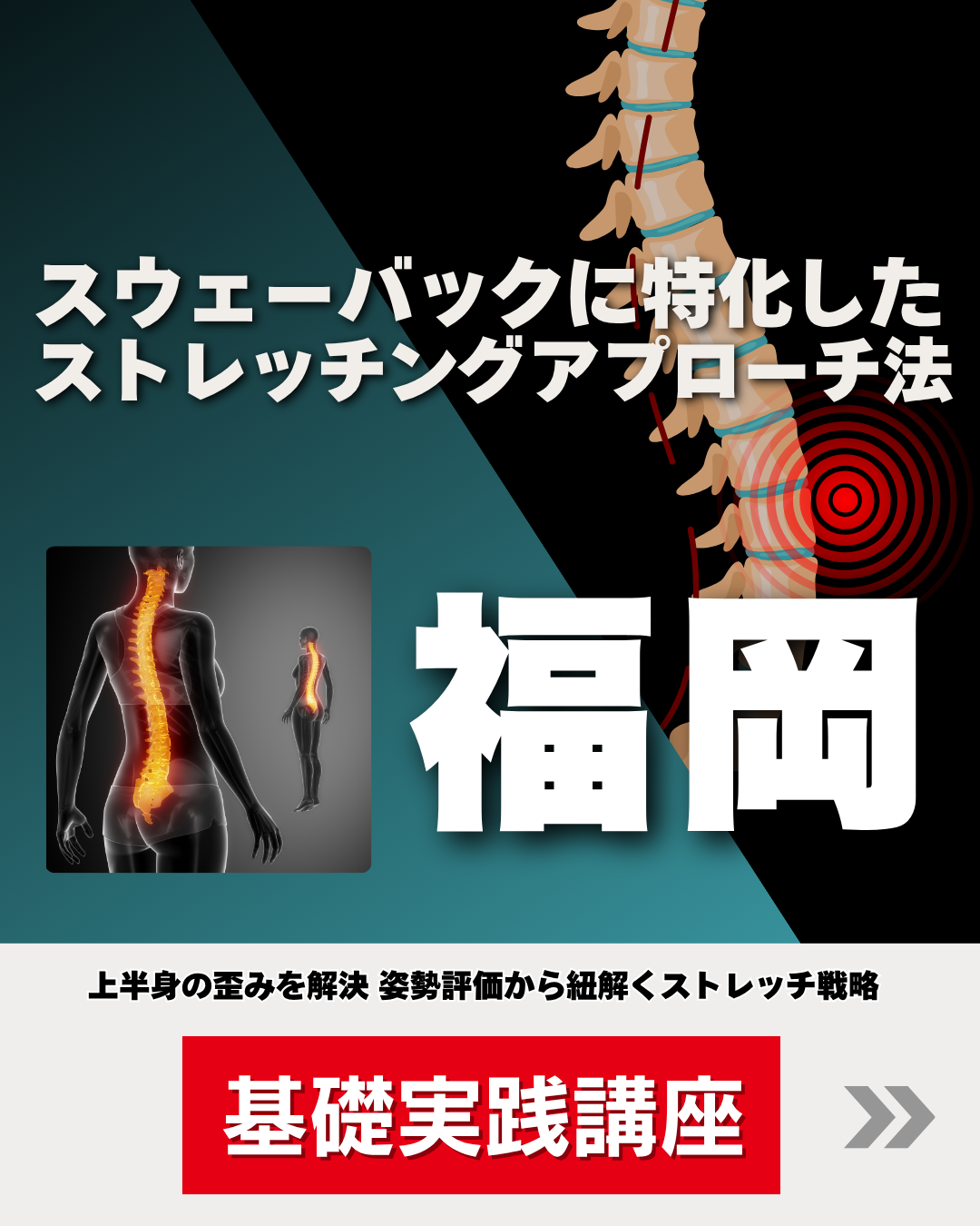 【福岡】スウェーバックに特化した ストレッチングアプローチ法